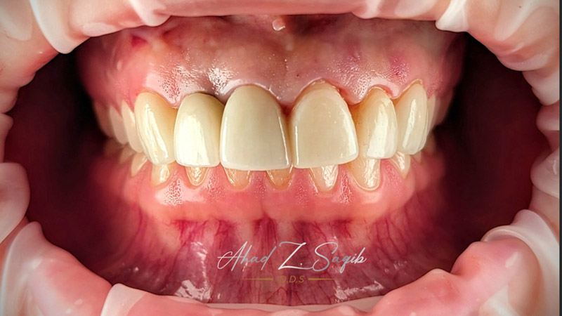 Restorative Dentistry