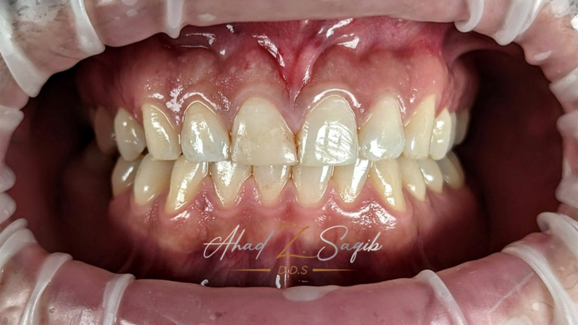 Colgate Oral Health Network